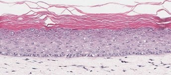 <b>A</b>. <i>In-Vitro</i> Organotypic Skin Culture