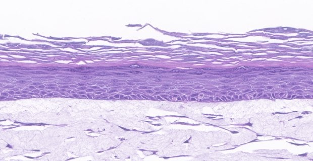 Organotypic skin models contain actively proliferating keratinocytes. (B)