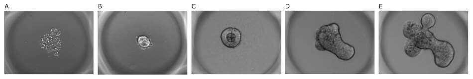 Mouse intestinal organoids grown on Millicell® Microwell plates over time