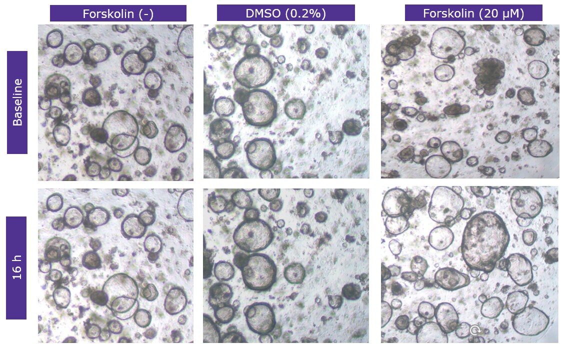 Morphology of colon organoids after forskolin-induced swelling