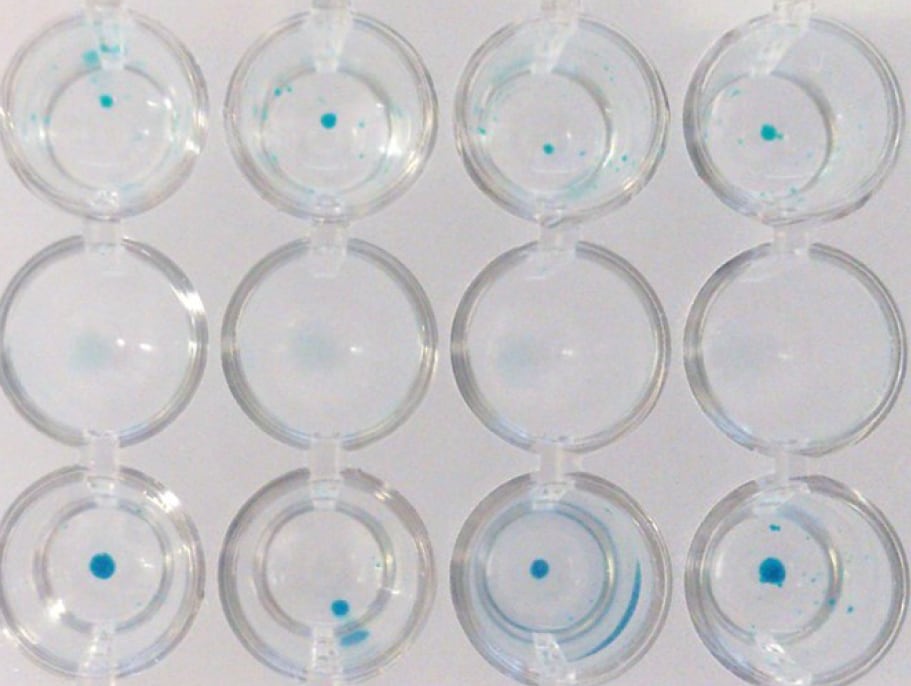 Alcian Blue staining of hMSC-BM derived chondrocytes