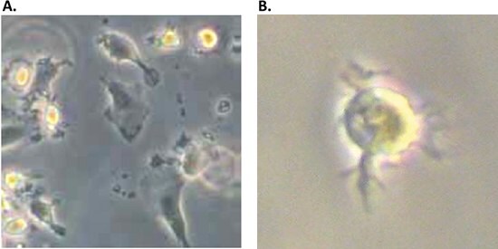 Morphology of immature and mature monocyte