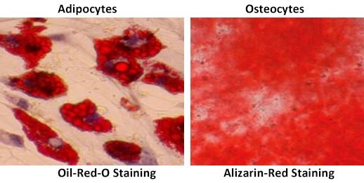 adipocytes and osteocytes