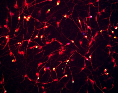 Cortical Glutamatergic Neurons Immunofluorescent microscopy image showing a dense network of cortical glutamatergic neurons, with bright red and yellow fluorescent signals highlighting the intricate structures and connections of the neurons against a dark background.