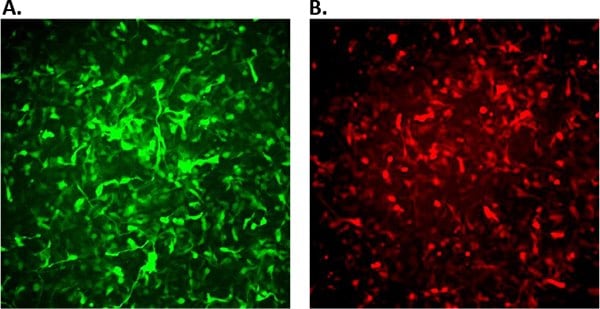 fluorescence-rencell Fluorescence images of ReNcell VM infected with APPSL-GFP