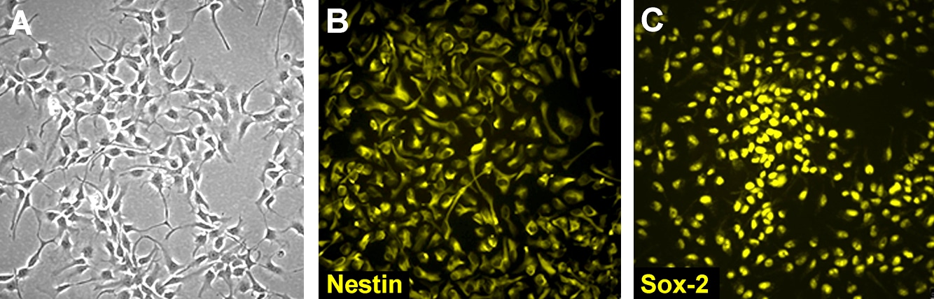 human_neural_stem_cell_lines Human neural stem cell lines