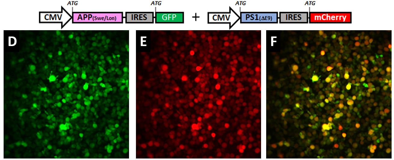 human_neural_stem_cell_lines_2 Human neural stem cell lines