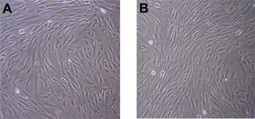 Phase contrast images of Human Mesenchymal Stem Cells