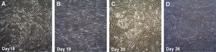 LIGHT DIAGNOSTICS Time course of human iPSC colonies generation using Human Simplicon RNA Reprogramming Kit
