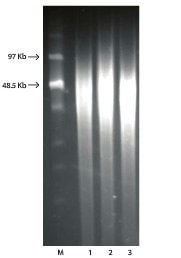 用GenElute™细菌gDNA试剂盒分离的细菌gDNA的PFGE。
