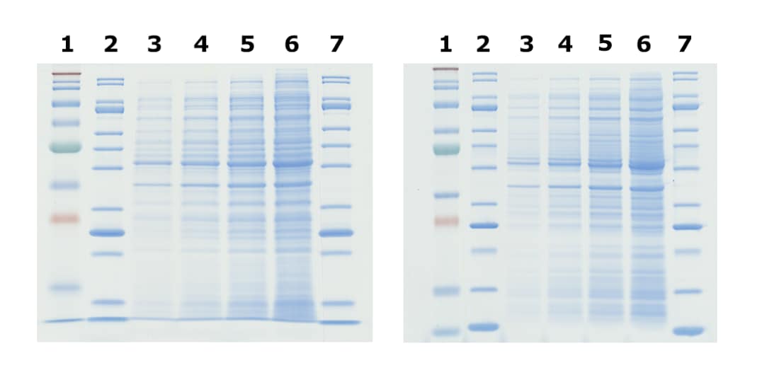 Comparison of Tris-Glycine (left) and Bis-Tris (right) gels