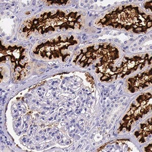 Immunohistochemical staining of human kidney tissue sections