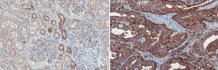 Immunohistochemistry Formalin Fixed Paraffin