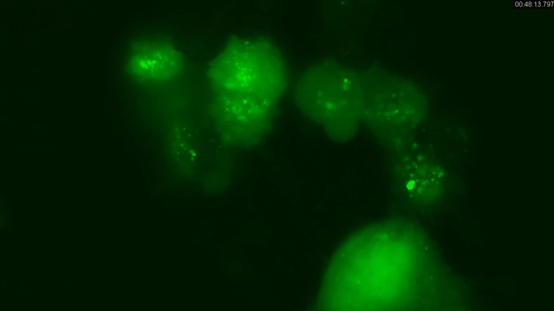 Live Cell Imaging of Autophagy using LentiBrite™ Fluorescent Biosensors