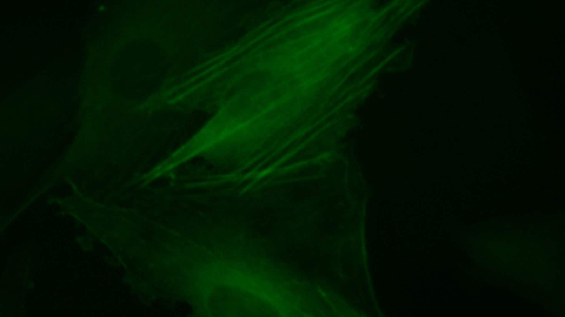 Live Cell Imaging of β-Actin Cytoskeleton Proteins using LentiBrite™ Fluorescent Biosensors