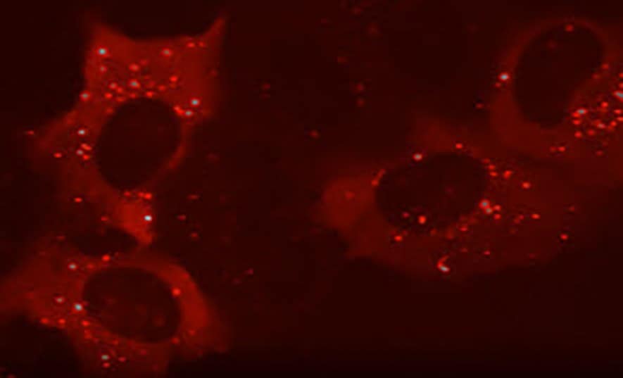 Live Cell Imaging of p62 using LentiBrite™ Fluorescent Biosensors