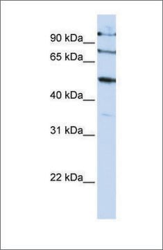 Anti-FBXO5 antibody produced in rabbit affinity isolated antibody