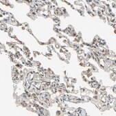 Anti-EFNB2 antibody produced in rabbit Prestige Antibodies&#174; Powered by Atlas Antibodies, affinity isolated antibody, buffered aqueous glycerol solution