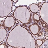 Anti-GANAB antibody produced in rabbit Prestige Antibodies&#174; Powered by Atlas Antibodies, affinity isolated antibody, buffered aqueous glycerol solution