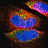 Anti-SDHB antibody produced in rabbit Ab1, Prestige Antibodies® Powered by Atlas Antibodies, affinity isolated antibody, buffered aqueous glycerol solution