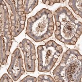 Anti-COQ8B antibody produced in rabbit Prestige Antibodies&#174; Powered by Atlas Antibodies, affinity isolated antibody, buffered aqueous glycerol solution, ab1