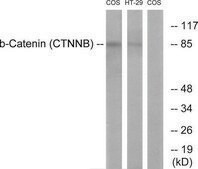 Anti-Catenin-β antibody produced in rabbit affinity isolated antibody