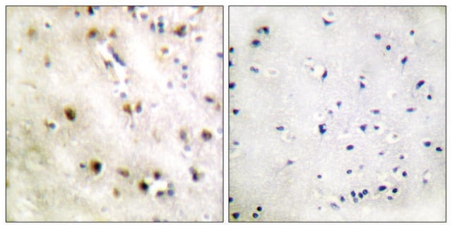 Anti-TISB antibody produced in rabbit affinity isolated antibody
