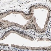 Anti-ZNF174 antibody produced in rabbit Prestige Antibodies&#174; Powered by Atlas Antibodies, affinity isolated antibody, buffered aqueous glycerol solution