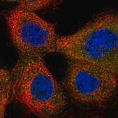 Anti-CXORF38 antibody produced in rabbit Prestige Antibodies&#174; Powered by Atlas Antibodies, affinity isolated antibody, buffered aqueous glycerol solution