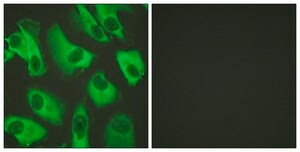 Anti-Kir5.1 (Ab-416) antibody produced in rabbit affinity isolated antibody