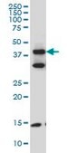 Monoclonal Anti-FBLIM1 antibody produced in mouse clone 5E11, purified immunoglobulin, buffered aqueous solution
