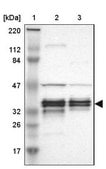Anti-C1orf198 antibody produced in rabbit Prestige Antibodies&#174; Powered by Atlas Antibodies, affinity isolated antibody, buffered aqueous glycerol solution