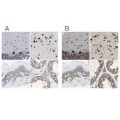Anti-G3BP2 antibody produced in rabbit Prestige Antibodies&#174; Powered by Atlas Antibodies, affinity isolated antibody, buffered aqueous glycerol solution