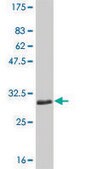 Monoclonal Anti-SLC11A1 antibody produced in mouse clone 2G2, purified immunoglobulin, buffered aqueous solution