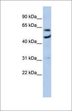 Anti-CNOT6 antibody produced in rabbit affinity isolated antibody