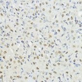 Anti-Phospho-Histone H3-T32 antibody produced in rabbit
