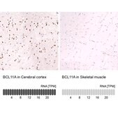Monoclonal Anti-Bcl11A Antibody Produced In Mouse Prestige Antibodies&#174; Powered by Atlas Antibodies, clone CL13501, affinity isolated antibody, buffered aqueous glycerol solution