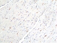 Anti-ANO1 / DOG1 / TMEM16A Rabbit Monoclonal Antibody clone RM440, affinity purified immunoglobulin