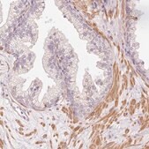Anti-SLC29A3 antibody produced in rabbit Prestige Antibodies&#174; Powered by Atlas Antibodies, affinity isolated antibody, buffered aqueous glycerol solution