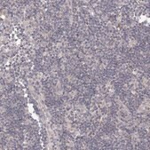 Anti-TACC2 antibody produced in rabbit Prestige Antibodies&#174; Powered by Atlas Antibodies, affinity isolated antibody, buffered aqueous glycerol solution