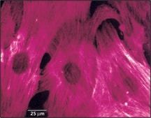 Monoclonal Anti-Actin, &#945;-Smooth Muscle clone 1A4, ascites fluid