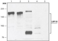 Anti-LRP1B (C-terminal region) antibody produced in rabbit ~1.5 mg/mL, affinity isolated antibody