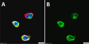 Anti-CD1a Antibody, clone 3J8 ZooMAb® Rabbit Monoclonal recombinant, expressed in HEK 293 cells
