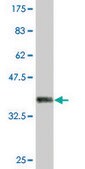 Monoclonal Anti-IARS, (C-terminal) antibody produced in mouse clone 3D3, purified immunoglobulin, buffered aqueous solution