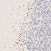 Anti-NKX2-2 antibody produced in rabbit Prestige Antibodies&#174; Powered by Atlas Antibodies, affinity isolated antibody, buffered aqueous glycerol solution