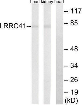 Anti-LRRC41 antibody produced in rabbit affinity isolated antibody