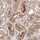 Anti-INPP4B antibody produced in rabbit Prestige Antibodies&#174; Powered by Atlas Antibodies, affinity isolated antibody, buffered aqueous glycerol solution