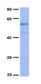 Anti-PIM1, (N-terminal) antibody produced in rabbit affinity isolated antibody