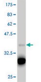 ANTI-TBX18 antibody produced in mouse clone 1A1, purified immunoglobulin, buffered aqueous solution
