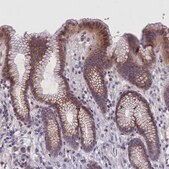 Anti-IGFALS antibody produced in rabbit Prestige Antibodies&#174; Powered by Atlas Antibodies, affinity isolated antibody, buffered aqueous glycerol solution